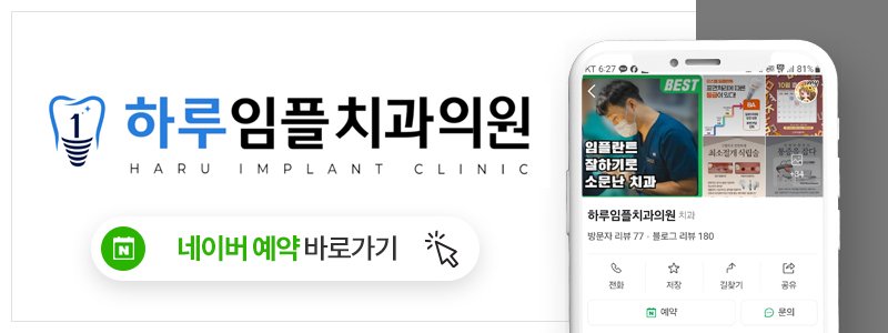 울산 흔들리는 이 치료 치과